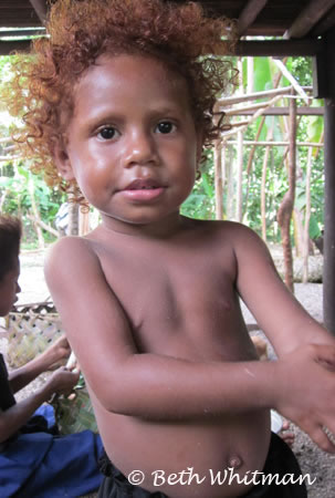 Child with ginger hair at Tawali village papua new guinea