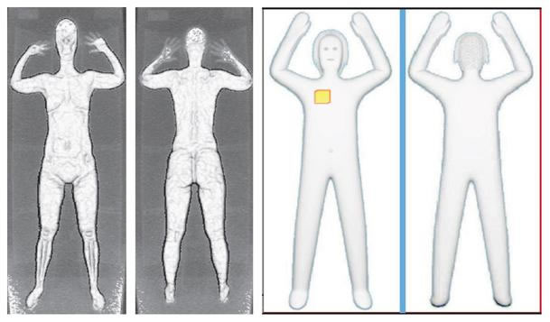 Millimeter Wave Scanner